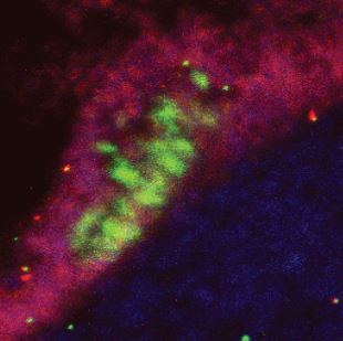 Peripheral neural stem cells (pNSCs)

 