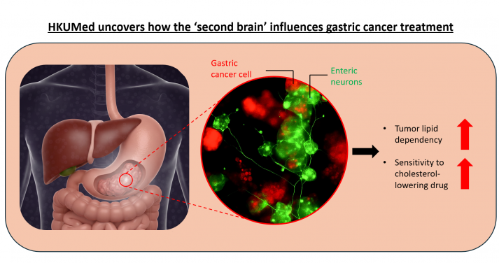 HKUMed researchers have developed a model to simulate the interaction between enteric neurons and gastric cancer tumours. The results revealed elevated fatty acid metabolism levels within cancer cells, indicating heightened lipid dependency. The use of cholesterol inhibitors significantly enhanced the efficacy of killing cancer cells by 6.3 times.
 