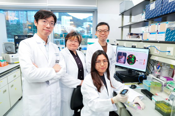 Professor Alan Wong Siu-lun (left) said that by identifying fatty acid metabolic factors as potential biomarkers will enable doctors to match patients with the most suitable treatment plans more accurately and effectively in the future, thereby enhancing therapeutic outcomes and success rates.
 